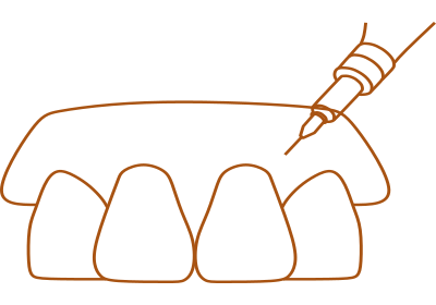 麻酔針注入-アイコン