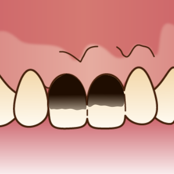 サホライド塗布