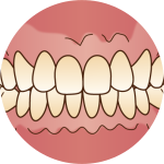 オフィスホワイトニング-1
