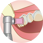 オフィスホワイトニング-2