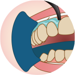 オフィスホワイトニング-3