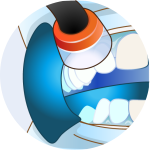 オフィスホワイトニング-5